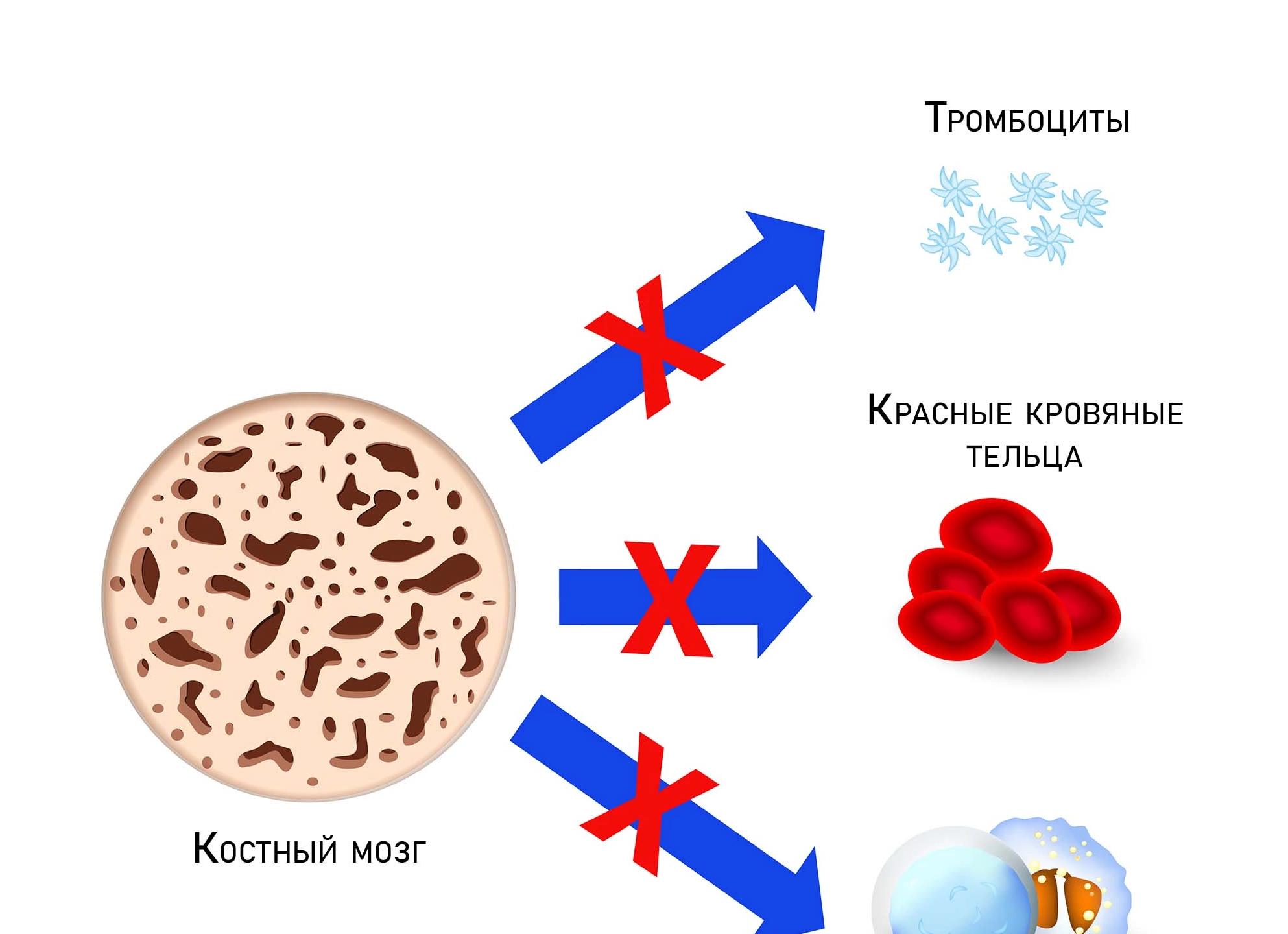 Апластическая анемия что это