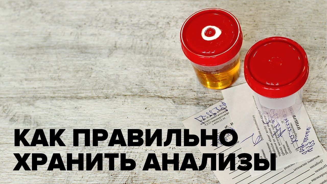 Можно ли хранить в холодильнике анализы кала