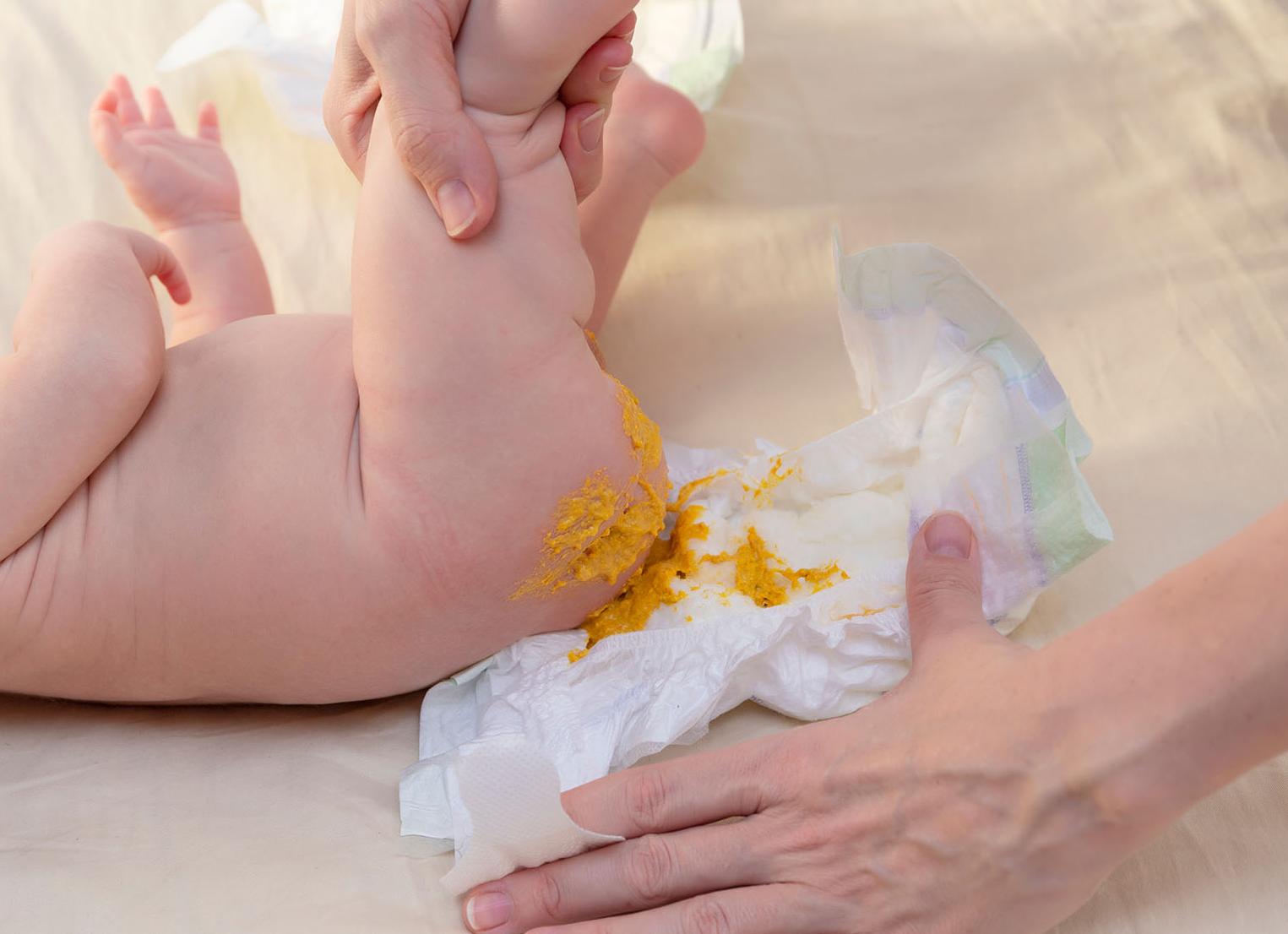 Какой должен быть кал у грудничка