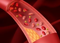 Как проверить сосуды всего организма Как проверить сосуды всего организма