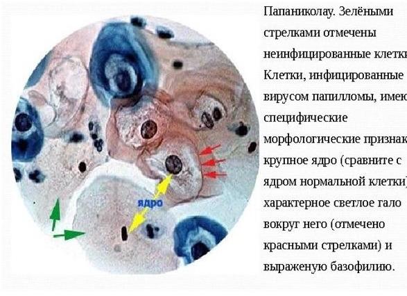 Эпителий цилиндрический в мазке норма у женщин