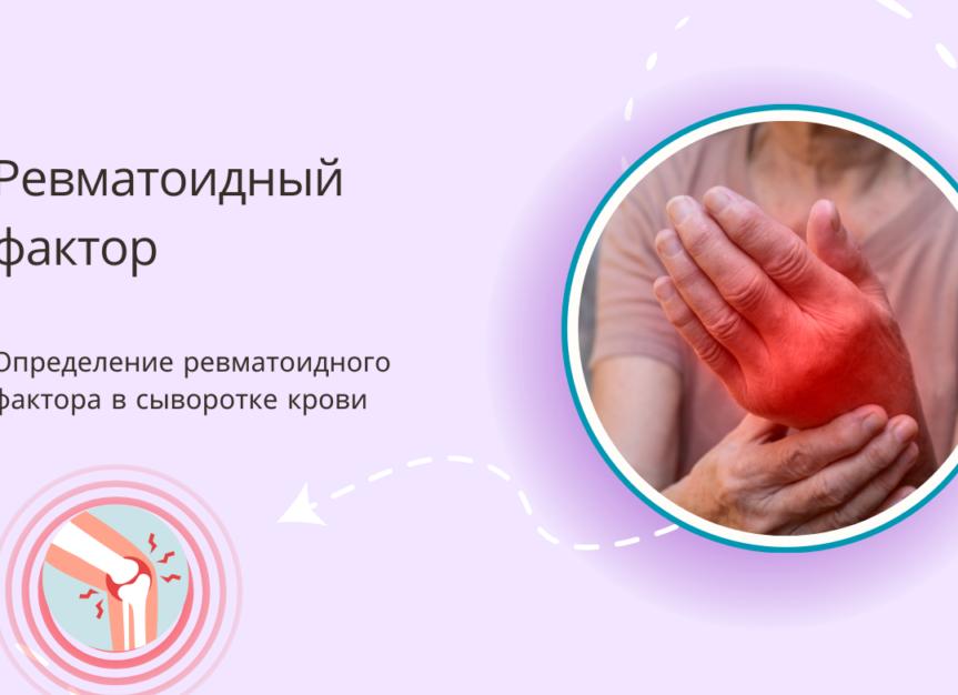 Что такое ревматоидный фактор