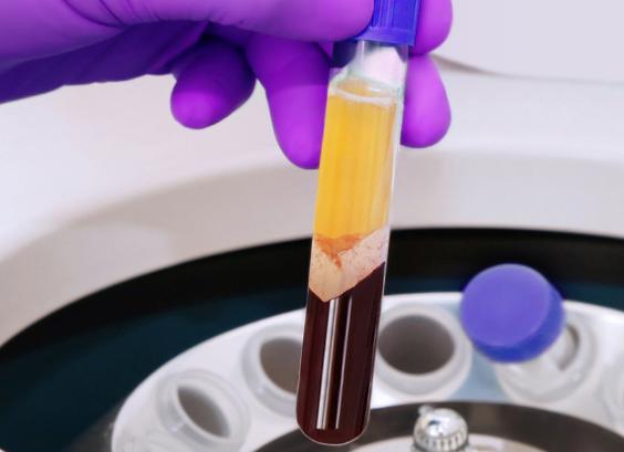 Аспартат трансаминаза что это такое