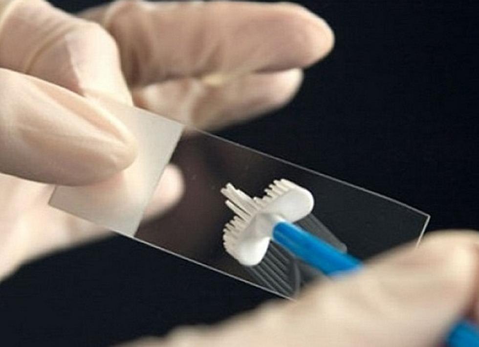 Анализ кала на энтеробиоз как сдавать ребенку Анализ кала на энтеробиоз как сдавать ребенку