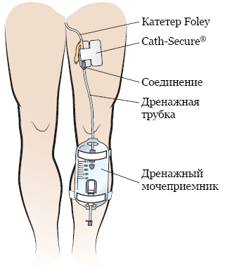 Гемоглобин следы в моче что это значит