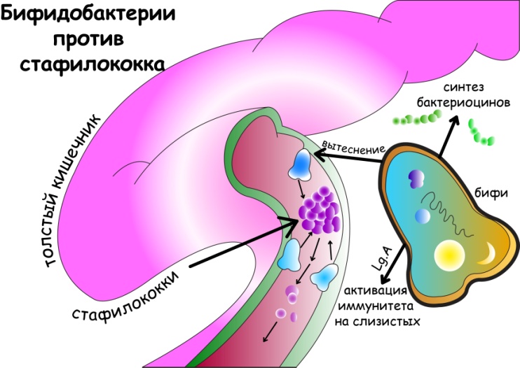Как проявляется золотистый стафилококк у грудничков