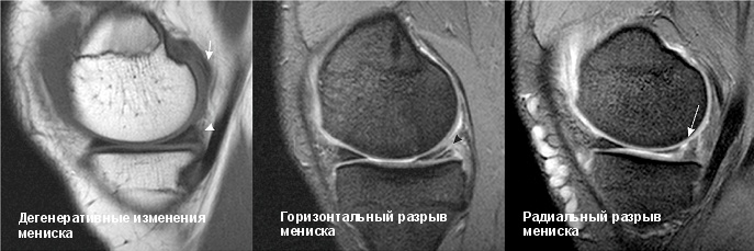 Мрт костей суставов и