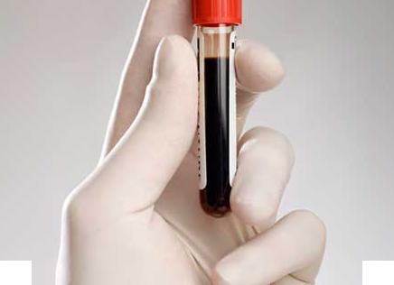 Кровь на эмдс что это Кровь на эмдс что это