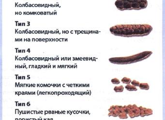 Кал темного цвета у взрослого причины