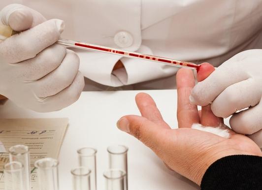 Как сдавать развернутый анализ крови