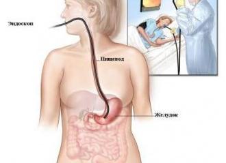 Гастроскопия обследование желудка
