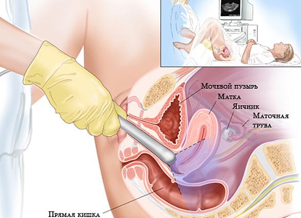 Что такое цервикометрия