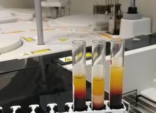 Анализ крови вместо манту ребенку