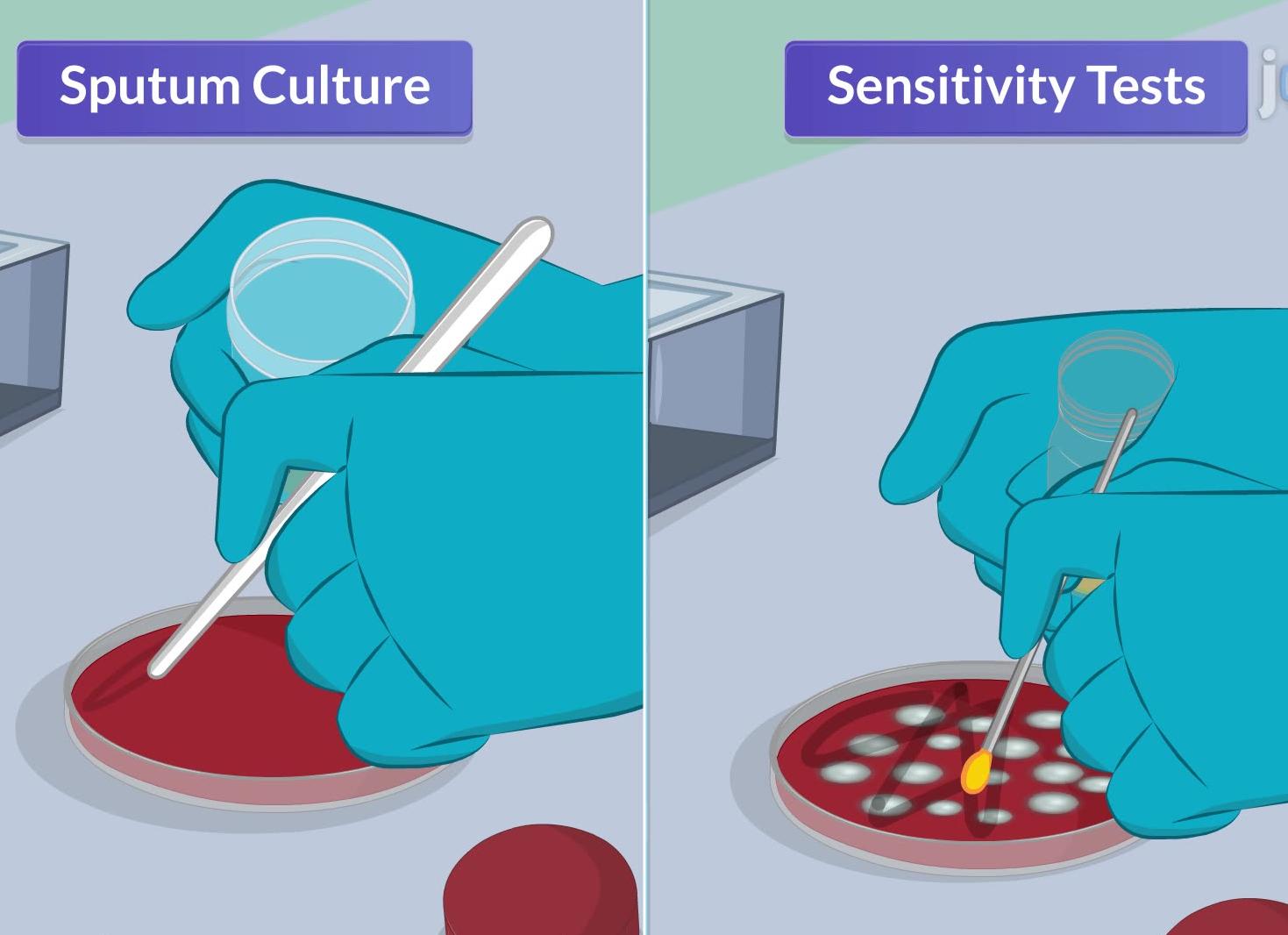 Анализ крови на стрептококковую инфекцию