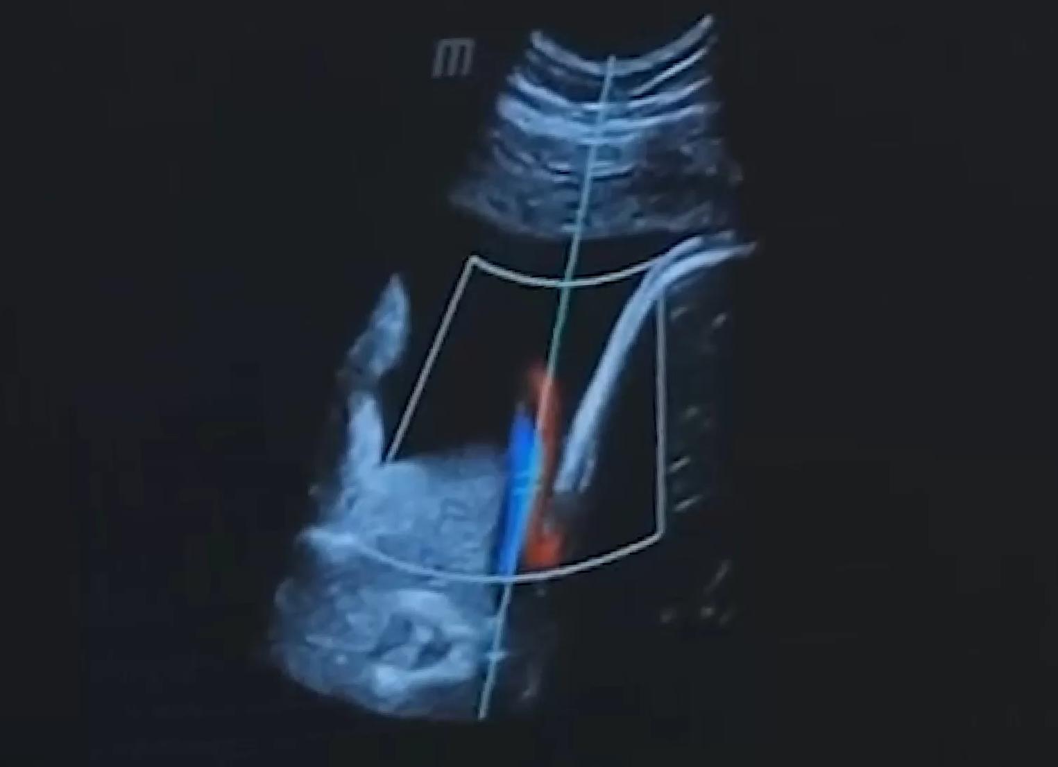 Акустический доступ затруднен что это значит