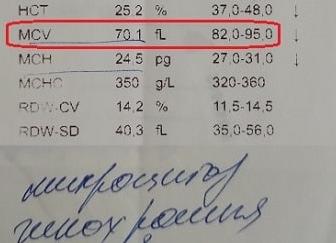 Микроцитоз что это Микроцитоз что это