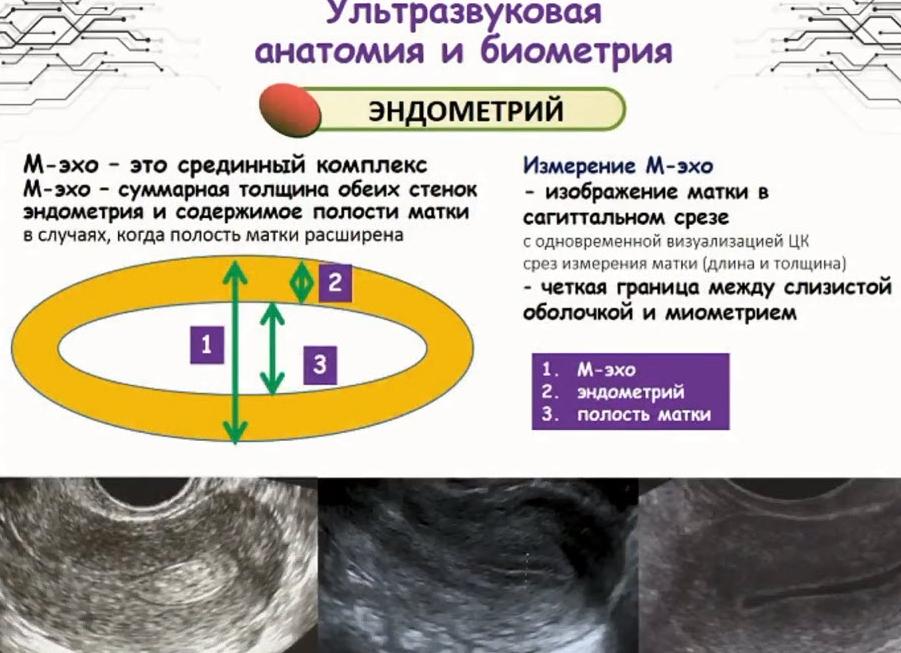М эхо в гинекологии что это такое