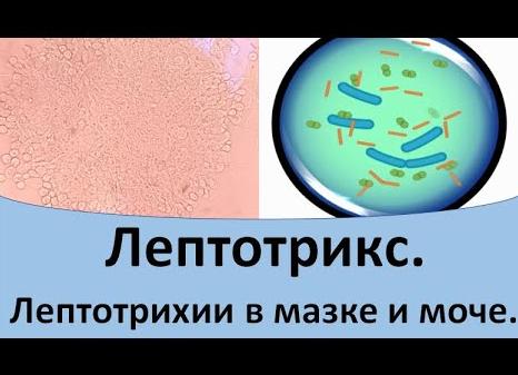 Лептотрикс чем лечить Лептотрикс чем лечить