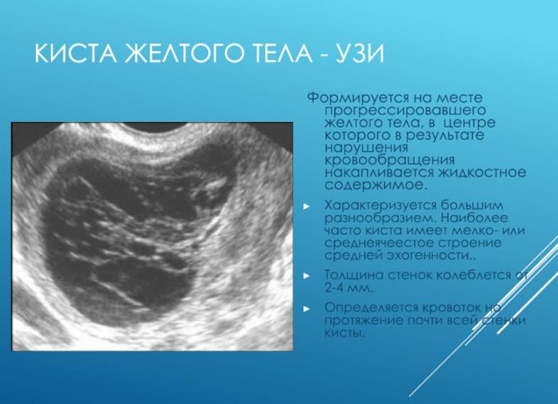 Когда желтое тело видно на узи