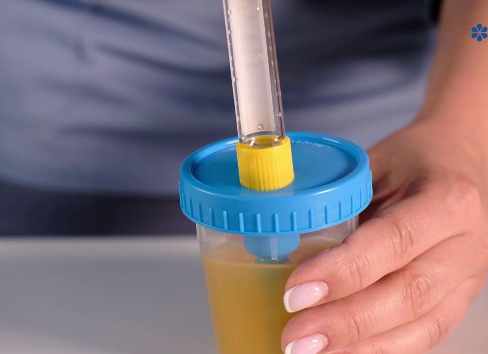 Как сдается моча на стерильность