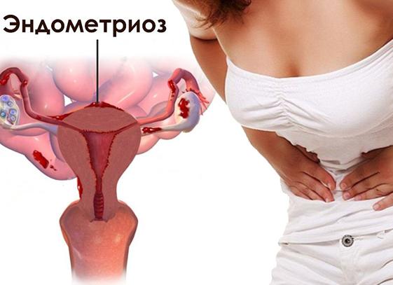 Эндометрий во время месячных