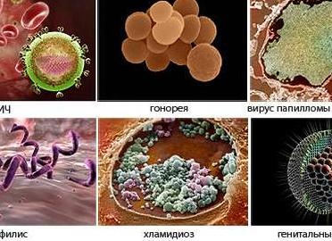 Бактерии передающиеся половым путем