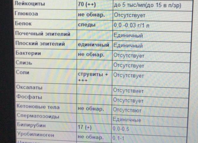 Анализ мочи соли