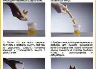 Анализ мочи на антибиотики