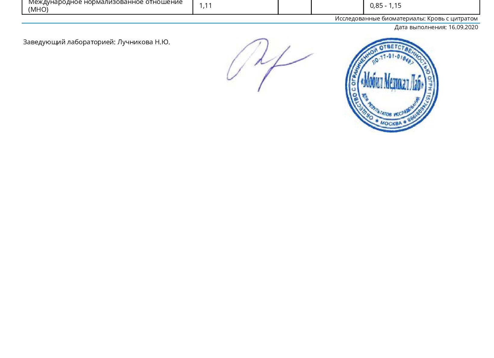 Анализ крови на протромбин