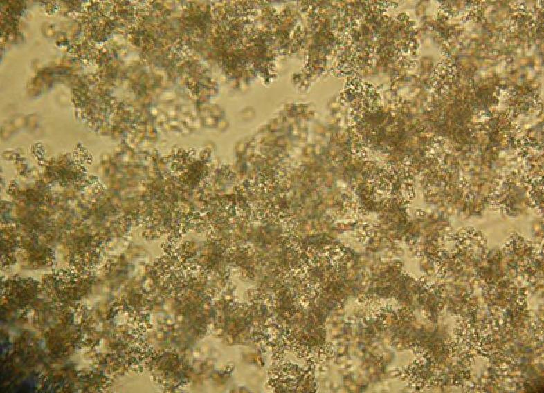 Аморфные фосфаты в моче что это значит