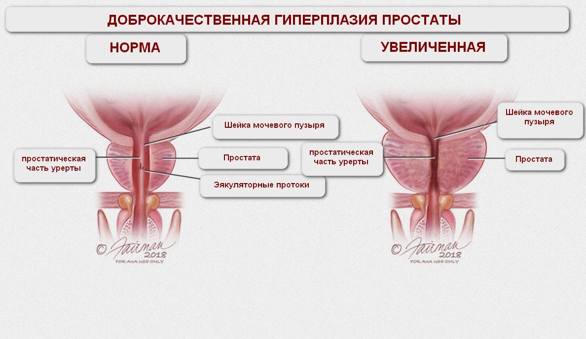 Гормоны предстательной железы