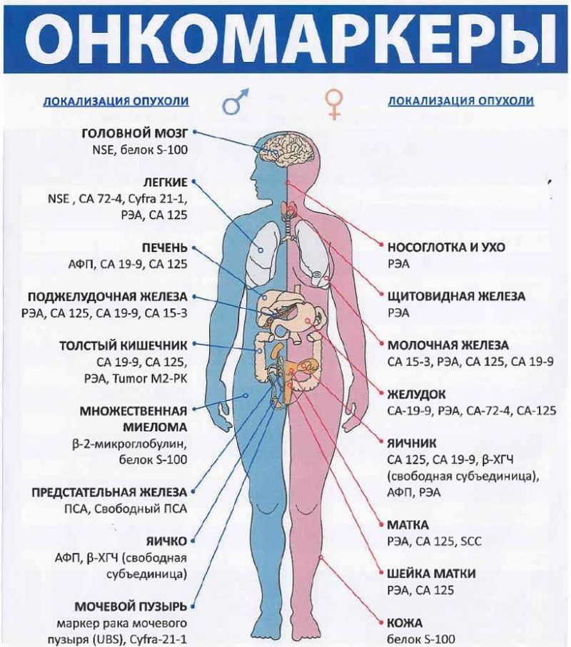 Какие анализы сдать на рак