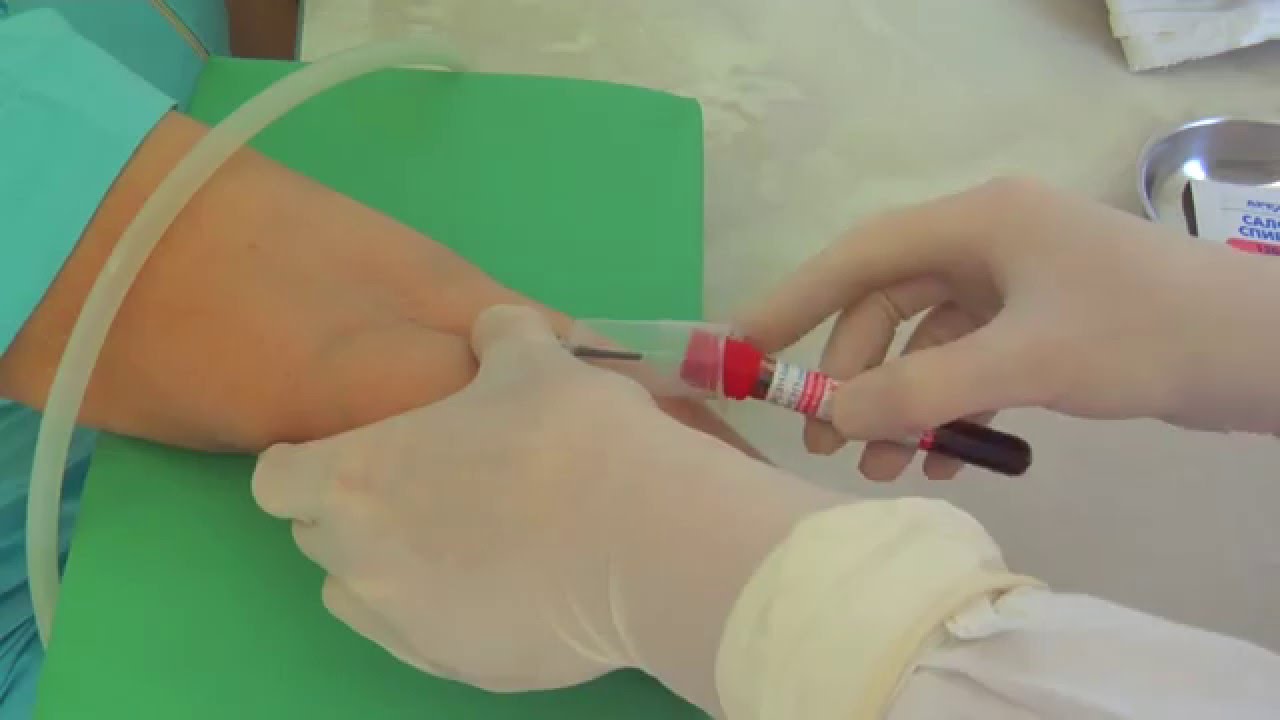Кровь из вены для чего берут