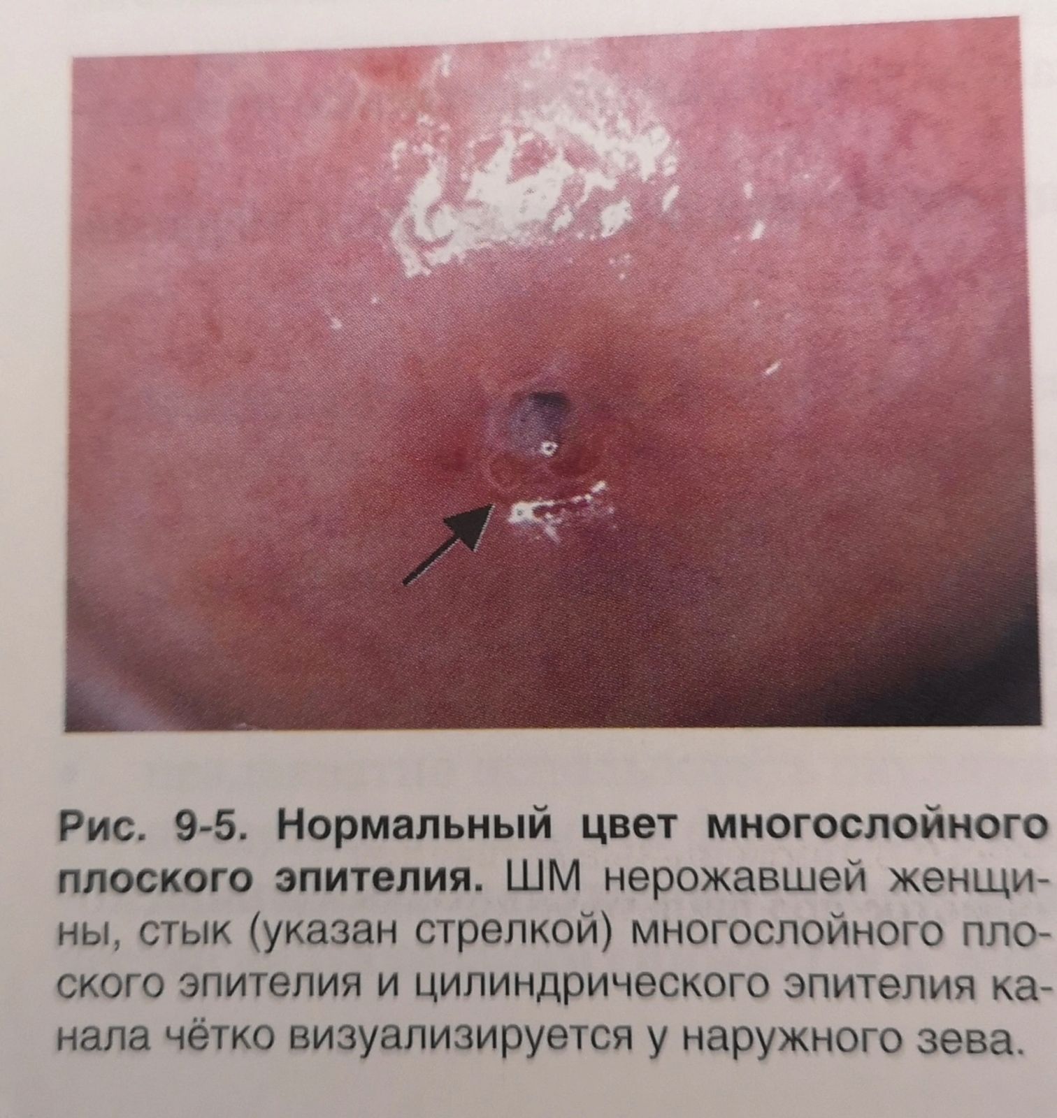 Лейкоциты в цервикальном канале норма у женщин