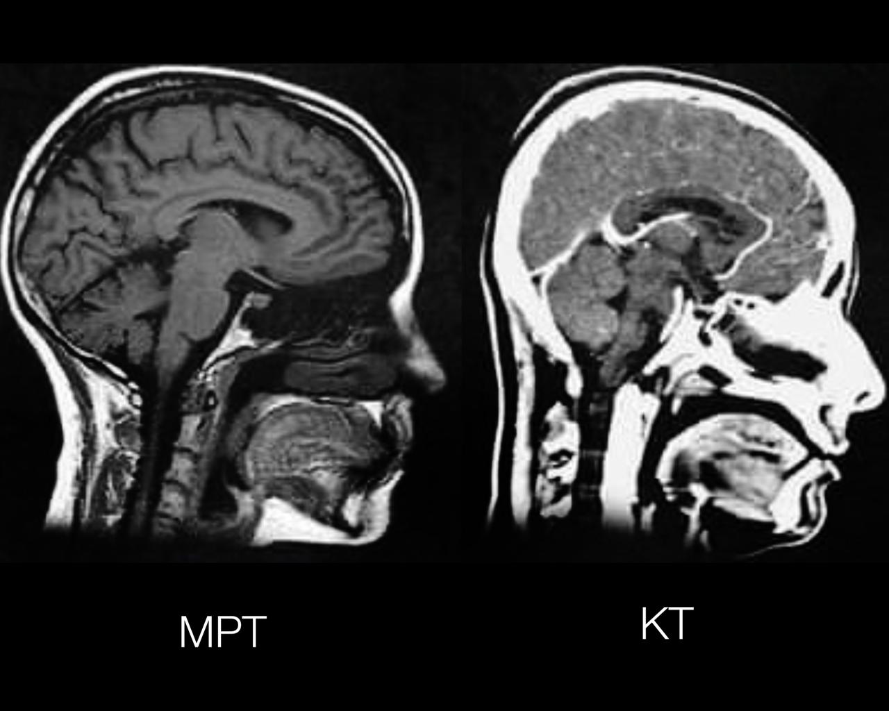 Мрт или компьютерная томография