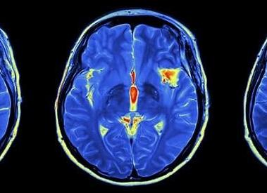 Мрт головного мозга с контрастным веществом