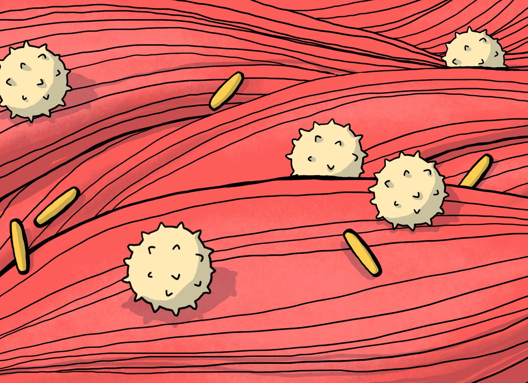 Креатинин в крови повышена причины как лечить
