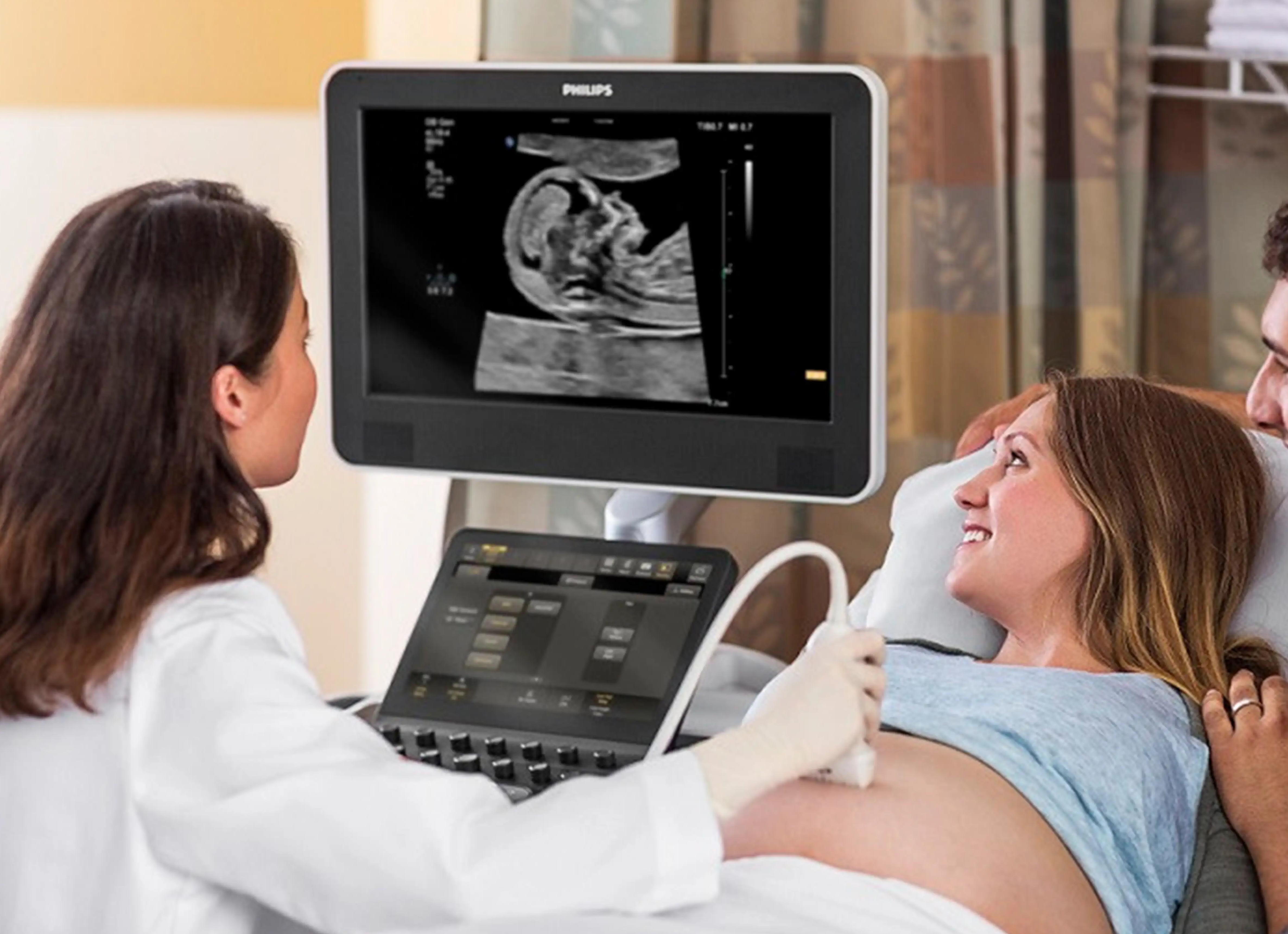 Кисты сосудистых сплетений головного мозга