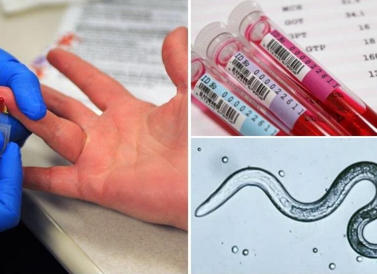 Как сдавать кровь на паразиты