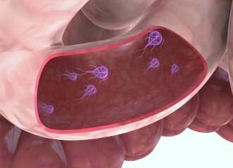 Как сдавать анализ на лямблии Как сдавать анализ на лямблии