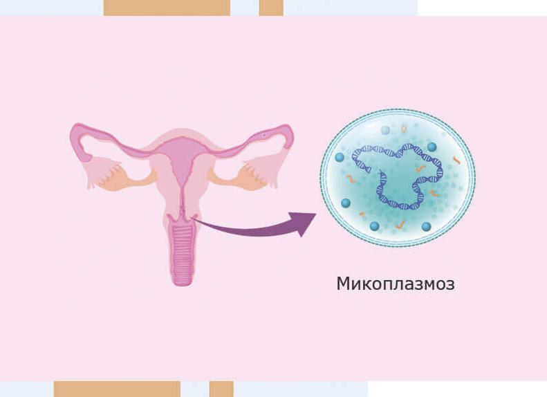 Инкубационный период микоплазма гениталиум