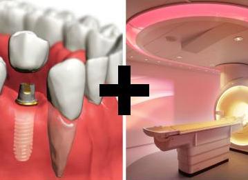 Импланты зубов и мрт