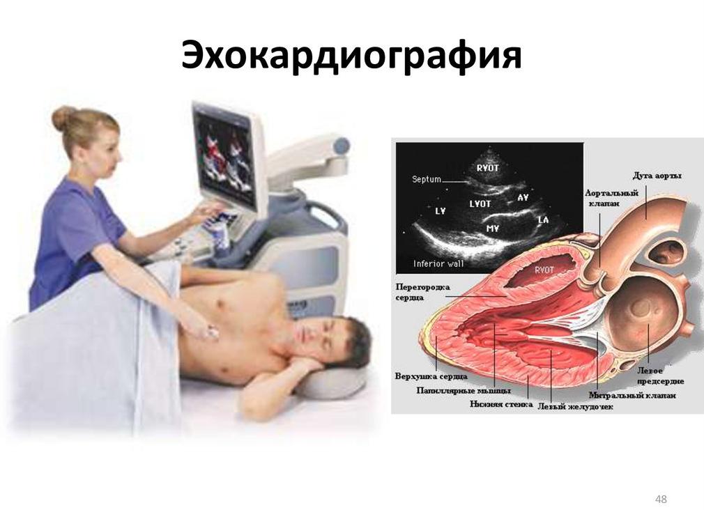 Эхокардиография с допплеровским анализом что это