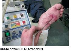 Биотезиометрия что это