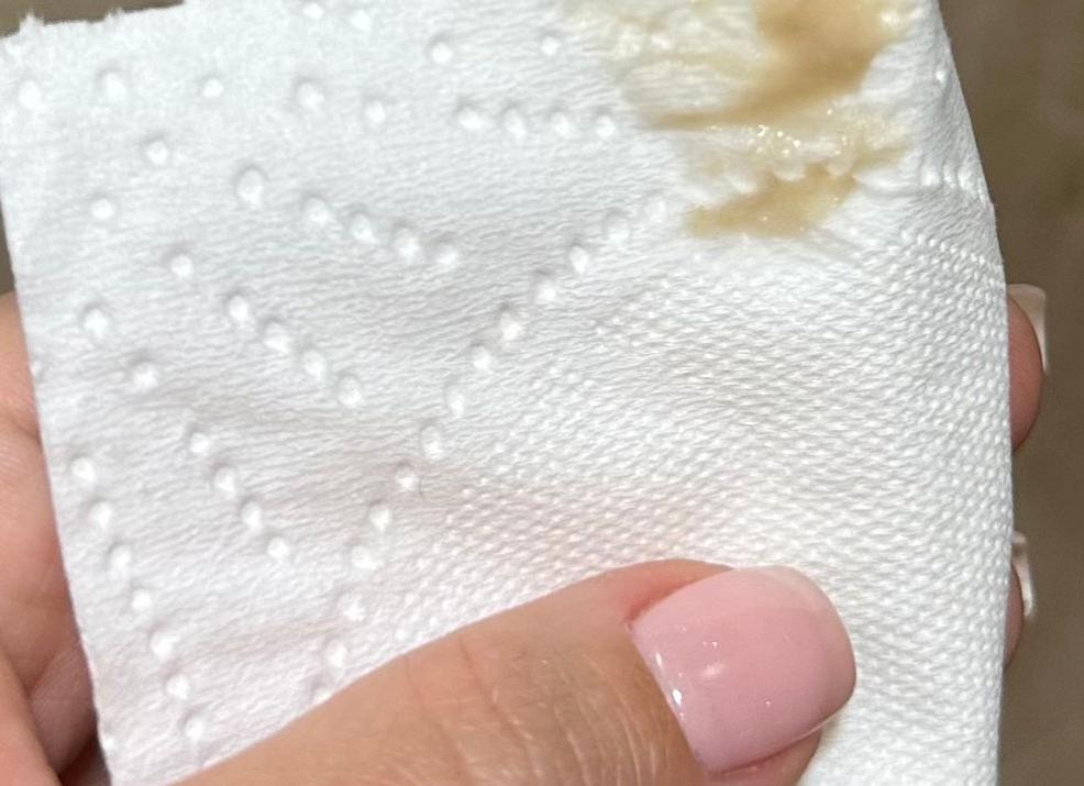 Бежевые выделения в 1 триместре