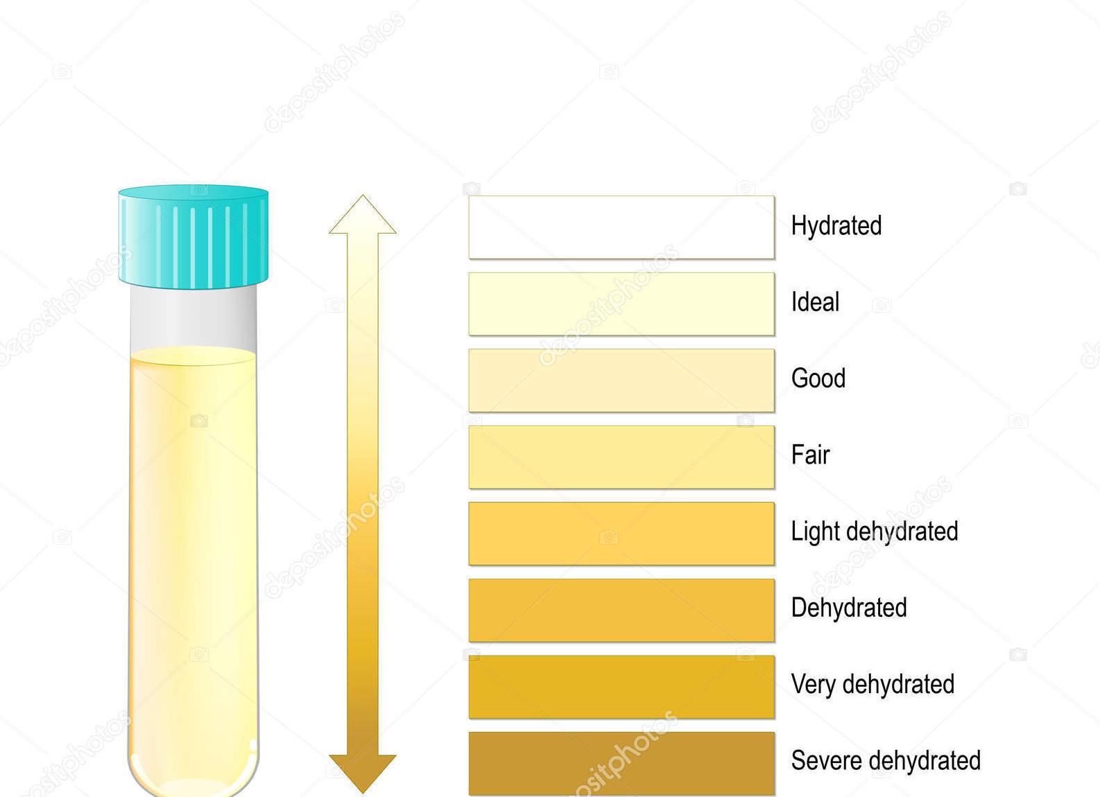 Белый цвет мочи Белый цвет мочи