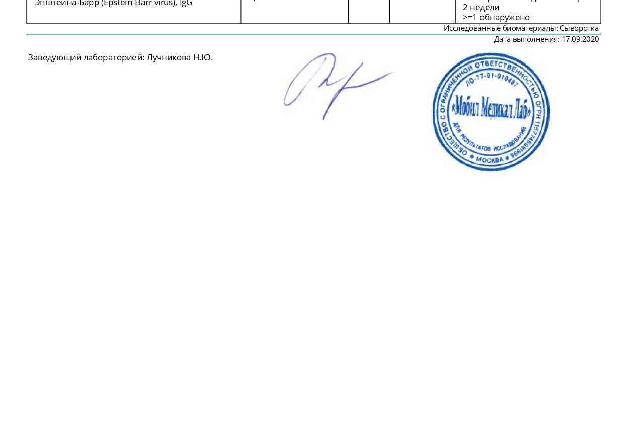 Анализ на эпштейна барра