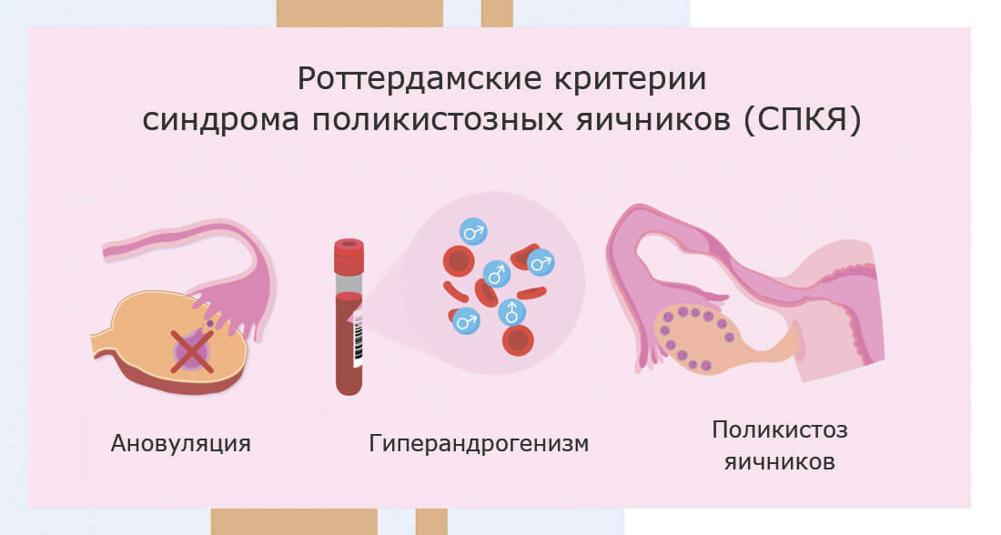 Гормоны андрогены у женщин