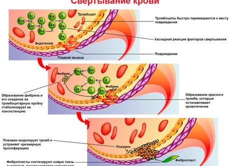 Как снизить фибриноген в крови
