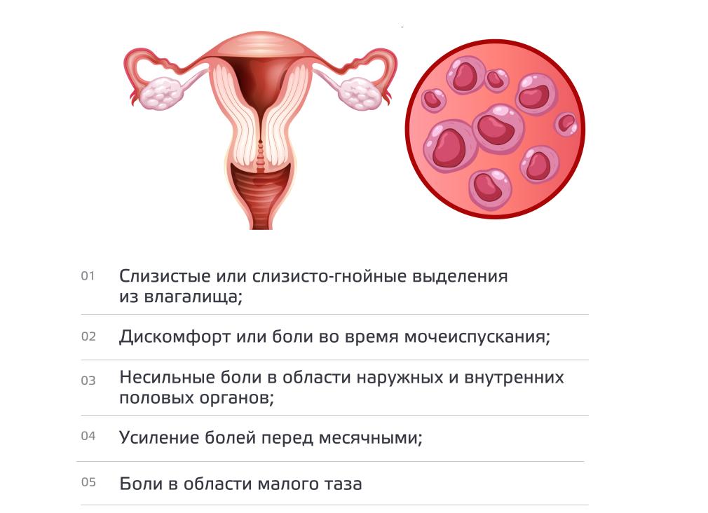 Хламидиоз что такое